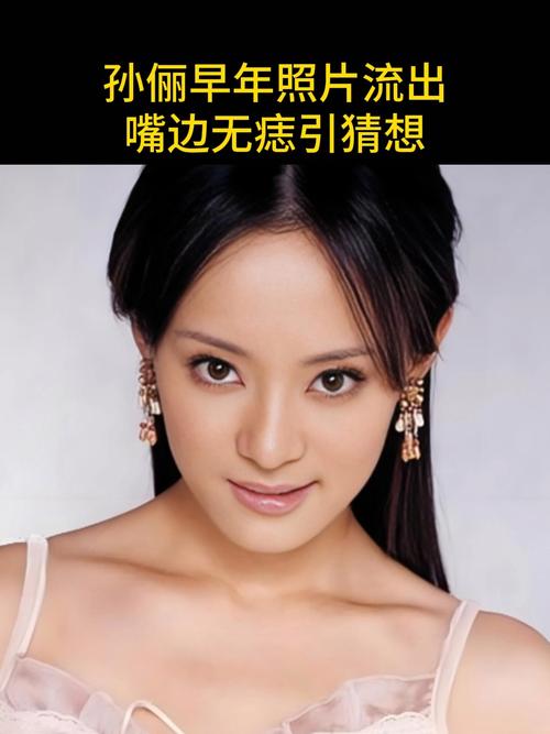 （孙俪嘴唇的痣）